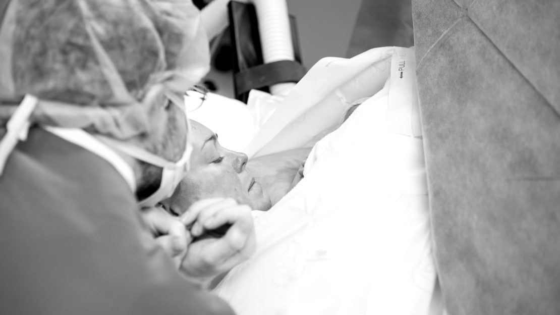 Maternal Assisted Keizersnede